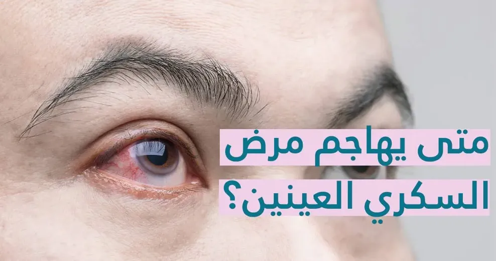 ‏العين ومرض السكري